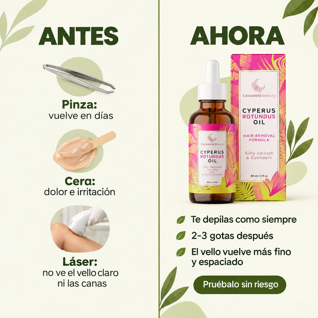 Antes y ahora: pinza, cera y láser frente al aceite de Cyperus Rotundus